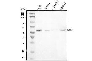 Western blot analysis of BCKDK using anti-BCKDK antibody (ABIN7601470).