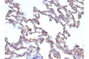 Immunohistochemistry (IHC) image for anti-Moesin (MSN) antibody (ABIN6940082)