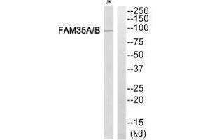 Western blot analysis of extracts from Jurkat cells, using FAM35A/B antibody. (FAM35A 抗体)