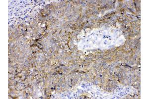 IHC analysis of CD147/Emmprin using anti-CD147/Emmprin antibody . (CD147 抗体  (AA 138-323))
