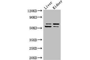 Western Blot Positive WB detected in: Mouse liver tissue, Mouse kidney tissue All lanes: LMBRD1 antibody at 4 μg/mL Secondary Goat polyclonal to rabbit IgG at 1/50000 dilution Predicted band size: 62, 45, 54, 22 kDa Observed band size: 62, 54 kDa (LMBRD1 抗体  (AA 6-100))