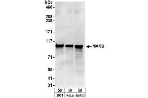 anti-Mars (MARS) (AA 175-225) antibody