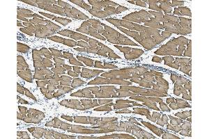 IHC analysis of NDUFB10 using anti-NDUFB10 antibody (ABIN7601461).