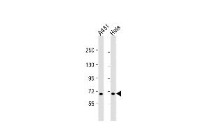 All lanes : Anti-CCD Antibody (N-term) at 1:1000 dilution Lane 1: A431 whole cell lysate Lane 2: Hela whole cell lysate Lysates/proteins at 20 μg per lane. (CCDC120 抗体  (N-Term))