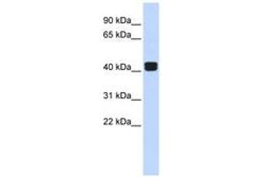 Image no. 1 for anti-TRIO and F-Actin Binding Protein (TRIOBP) (AA 144-193) antibody (ABIN6742513) (TRIOBP 抗体  (AA 144-193))