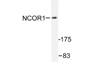 Image no. 1 for anti-Nuclear Receptor Co-Repressor 1 (NCOR1) antibody (ABIN271948) (NCOR1 抗体)