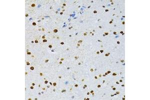 Immunohistochemistry of paraffin-embedded mouse spinal cord using SNRNP70 antibody. (SNRNP70 抗体  (AA 150-250))