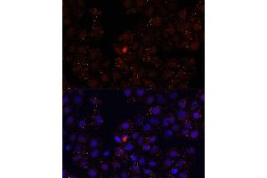 Immunofluorescence analysis of HeLa cells using WDR81 antibody (ABIN6294099) at dilution of 1:100. (WDR81 抗体)