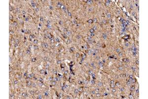 IHC analysis of GPR54/KISS1R using anti-GPR54/KISS1R antibody (ABIN7602153).