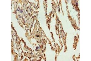 Immunohistochemistry of paraffin-embedded human lung tissue using ABIN7169989 at dilution of 1:100 (Solute Carrier Family 34 (Type II Sodium/phosphate Contransporter), Member 1 (SLC34A1) (AA 1-103) 抗体)