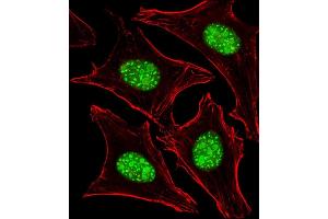 Immunofluorescent analysis of 4 % paraformaldehyde-fixed, 0. (Nucleostemin 抗体  (N-Term))
