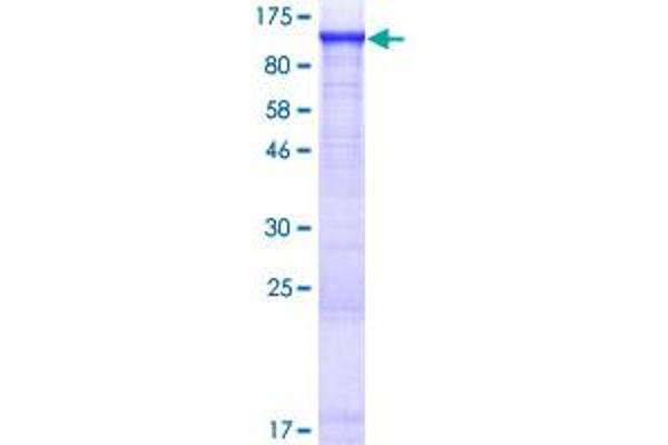 AMPD2 Protein (AA 1-798) (GST tag)
