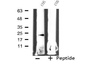 Western blot analysis of extracts from COS cells, using MRPL11 antibody. (MRPL11 抗体  (Internal Region))