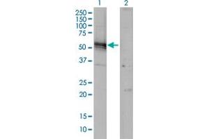 Western Blotting (WB) image for anti-Angiotensinogen (serpin Peptidase Inhibitor, Clade A, Member 8) (AGT) (AA 376-485) antibody (ABIN559812)