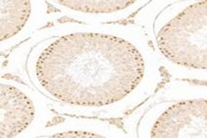 Immunohistochemistry analysis of paraffin-embedded rat testis using,ZCCHC7 (ABIN7076279) at dilution of 1: 3000 (ZCCHC7 抗体)
