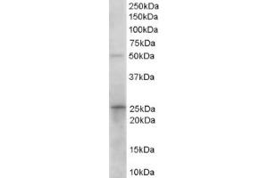 Image no. 1 for anti-Hydroxyprostaglandin Dehydrogenase 15-(NAD) (HPGD) (C-Term) antibody (ABIN374495) (HPGD 抗体  (C-Term))