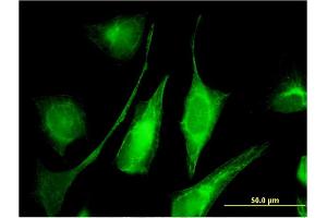 Immunofluorescence of monoclonal antibody to C6orf199 on HeLa cell. (AKD1 抗体  (AA 321-421))