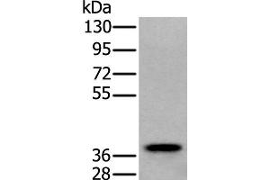 Western blot analysis of Human testis tissue lysate using ZPBP Polyclonal Antibody at dilution of 1:250 (ZPBP 抗体)