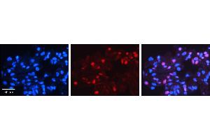 MXD4 antibody - N-terminal region          Formalin Fixed Paraffin Embedded Tissue:  Human Lung Tissue    Observed Staining:  Nucleus of pneumocytes   Primary Antibody Concentration:  1:100    Other Working Concentrations:  1/600    Secondary Antibody:  Donkey anti-Rabbit-Cy3    Secondary Antibody Concentration:  1:200    Magnification:  20X    Exposure Time:  0. (MXD4 抗体  (N-Term))