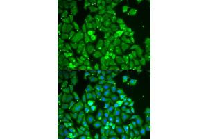 Immunofluorescence analysis of HeLa cells using STAT1 antibody (ABIN5998976). (STAT1 抗体)