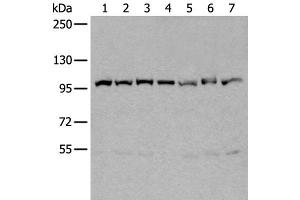 Western blot analysis of 231 Hela A549 A431 HEPG2 Jurkat and K562 cell lysates using VCP Polyclonal Antibody at dilution of 1:400 (VCP 抗体)