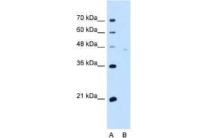 WB Suggested Anti-NPTN Antibody Titration:  5.