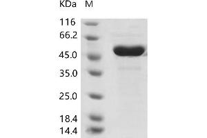 Western Blotting (WB) image for Coronavirus OC43 Nucleoprotein (HCoV-OC43 N) protein (His tag) (ABIN7198835) (HCoV-OC43 N Protein (His tag))
