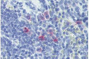 Rat spleen: Formalin-Fixed, Paraffin-Embedded (FFPE) (IL-13 抗体)