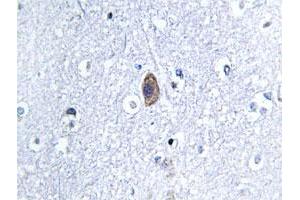 Immunohistochemical analysis of paraffin-embedded human brain tissue using CNN2 polyclonal antibody . (CNN2 抗体)