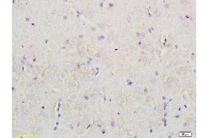 Immunohistochemistry (Paraffin-embedded Sections) (IHC (p)) image for anti-Opiate Receptor-Like 1 (OPRL1) (AA 1-47) antibody (ABIN725960)