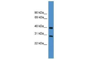 TIMP2 antibody used at 0. (TIMP2 抗体  (Middle Region))