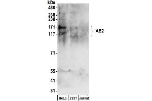 Western Blotting (WB) image for anti-Solute Carrier Family 4, Anion Exchanger, Member 2 (erythrocyte Membrane Protein Band 3-Like 1) (SLC4A2) (AA 275-325) antibody (ABIN7455039)