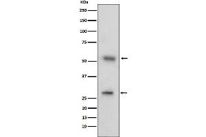 Western Blotting (WB) image for anti-CD97 (CD97) antibody (ABIN7606790)