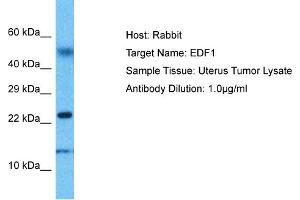 Host: Rabbit Target Name: EDF1 Sample Type: Uterus Tumor lysates Antibody Dilution: 1. (EDF1 抗体  (N-Term))
