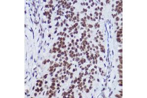 Immunohistochemistry (IHC) image for anti-Ubiquitin Specific Peptidase 39 (USP39) antibody (ABIN7271160)