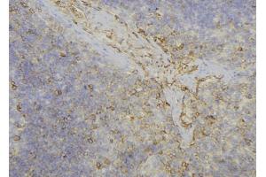 ABIN6277719 at 1/100 staining Human lymph node tissue by IHC-P. (ADH6 抗体)