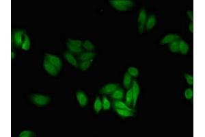 Immunofluorescent analysis of HepG2 cells using ABIN7142693 at dilution of 1:100 and Alexa Fluor 488-congugated AffiniPure Goat Anti-Rabbit IgG(H+L) (PFKFB2 抗体  (AA 360-505))