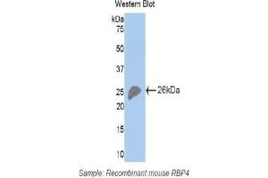 Western blot analysis of the recombinant protein. (RBP4 抗体  (AA 63-245))