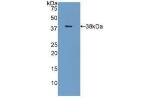 Detection of Recombinant GAL8, Human using Polyclonal Antibody to Galectin 8 (GAL8) (LGALS8 抗体  (AA 1-317))