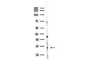 anti-WDYHV Motif Containing 1 (WDYHV1) antibody