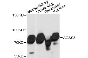 Western blot analysis of extracts of various cell lines, using ACSS3 antibody. (ACSS3 抗体)