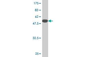 Western Blot detection against Immunogen (51. (TK1 抗体  (AA 1-234))
