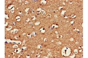 Immunohistochemistry of paraffin-embedded human brain tissue using ABIN7154490 at dilution of 1:100 (GAS7 抗体  (AA 1-153))