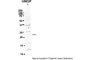 Sample Type: 1. (UBE2F 抗体  (N-Term))