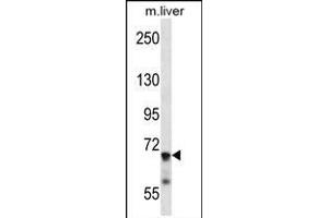 IL1R1 Antibody (C-term) (ABIN657915 and ABIN2846862) western blot analysis in mouse liver tissue lysates (35 μg/lane). (IL1R1 抗体  (C-Term))