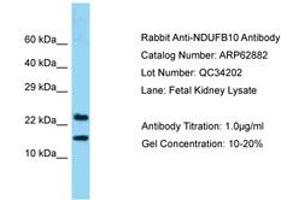 Image no. 1 for anti-NADH Dehydrogenase (Ubiquinone) 1 beta Subcomplex, 10, 22kDa (NDUFB10) (AA 91-140) antibody (ABIN6749956)