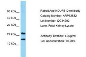 Image no. 1 for anti-NADH Dehydrogenase (Ubiquinone) 1 beta Subcomplex, 10, 22kDa (NDUFB10) (AA 91-140) antibody (ABIN6749956) (NDUFB10 抗体  (AA 91-140))