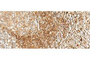 Immunohistochemistry of paraffin-embedded Human tonsil tissue using HLA-DPA1 Polyclonal Antibody at dilution of 1:35(x200) (HLA-DPA1 抗体)
