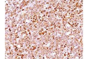Immunohistochemical staining (Formalin-fixed paraffin-embedded sections) of human tonsil with CD79A recombinant monoclonal antibody, clone IGA/1688R . (Recombinant CD79a 抗体  (AA 208-222))
