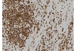 ABIN6260073 and ABIN6278423 at 1/100 staining Human gastric tissue by IHC-P.